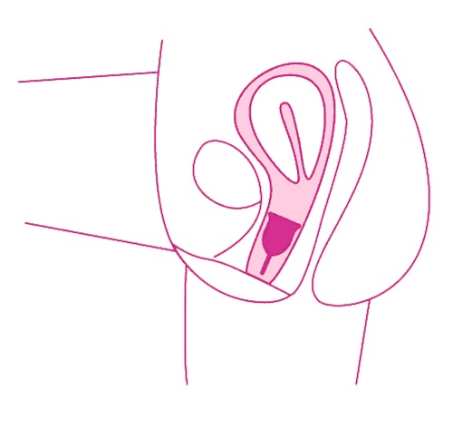 جاگذاری کاپ قاعدگی داخل واژن - آنلاین کاندوم